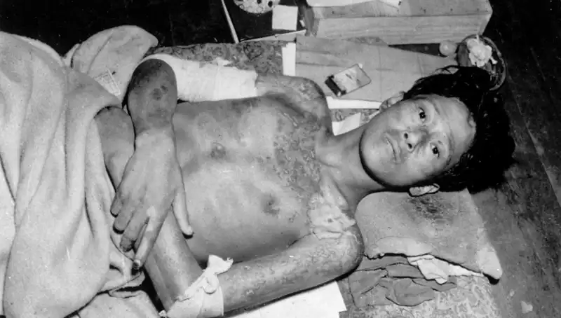 80 Yıl Sonra Nagasaki'den Gelen Sert Uyarı: Nükleer Felaket Kapıda!